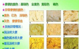 婴儿消化不良的大便图,婴儿消化不良大便特征解析